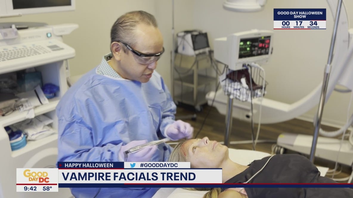 Benefits of the Vampire Facial trend